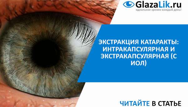 Экстракция катаракты интракапсулярная и экстракапсулярная